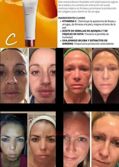 CREMA PARA LAS MANCHAS
